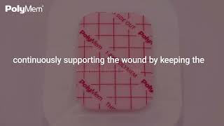 Wound Healing Journey with PolyMem Dressings  Part 2 Proliferative Phase [upl. by Arhoz]