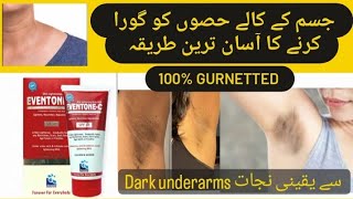 Whitening of Dark underarms  Eventone C cream uses [upl. by Andros]