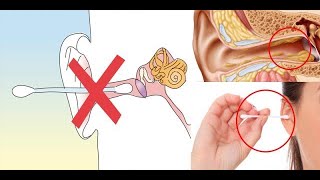 Voici la bonne façon d’enlever le cérumen de vos oreilles ne faites pas la même [upl. by Tennes805]