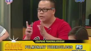 3 Signs of Pulmonary Tuberculosis [upl. by Merwin]