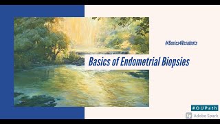 Basics of Endometrial Biopsies Tutorial for Residents [upl. by Nira]