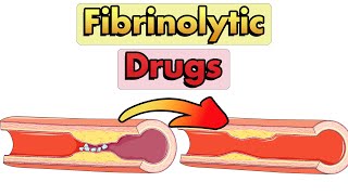 Fibrinolytic Drugs Thrombolytics Mechanism of Action Therapeutic Uses and Adverse Effects [upl. by Ativad]