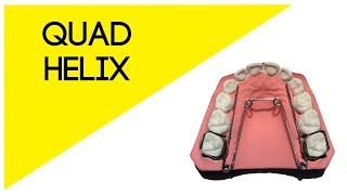 ❇️Elaboración de quotQUAD HELIXquot Aparato de Expansión Superior Fijo Odontología🦷 2020 [upl. by Nueovas954]