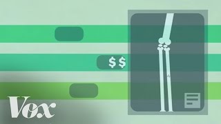 How singlepayer health care works in 2 minutes [upl. by Nosduj]