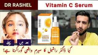 Dr Rashel Vitamin C Face Serum  HONEST REVIEW  Uses Side effects [upl. by Deerc]