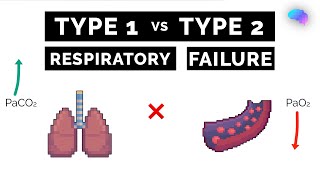 Type 1 vs Type 2 Respiratory Failure  ABG Interpretation  UKMLA  CPSA [upl. by Aneehsit]