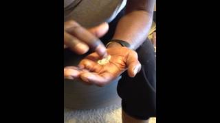 5 Minute Migraine CureVideo 1 [upl. by Krispin750]