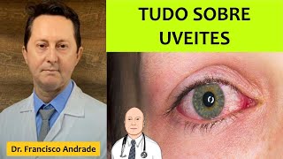 Uveítes dos sinais e sintomas ao diagnóstico e tratamento [upl. by Aihsenek]