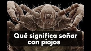 🐜 Qué significa soñar con piojos soñar que los tienes se caen son blancos 💤 Interpretando sueños [upl. by Fredek]