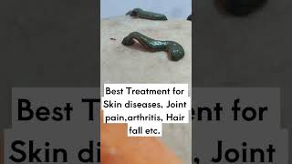 The leech Therapy Best treatment for skin disorders skincare skindiseases leeching [upl. by Soule393]