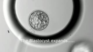 Blastocyst Development  Day 3 to Day 5 MUST SEE [upl. by Ssidnac]