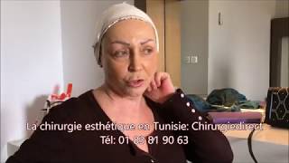 Chirurgie esthetique Tunisie lifting cervico facial à 66 ans [upl. by Schecter]