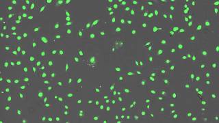 Time Lapse Imaging of BPAEC Cells Treated With Menadione [upl. by Aicile]