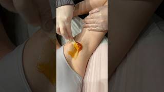 ASMR Underarm Wax On Short Hair🔎 wax asmrwax asmr asmrsounds underarmwax satisfying shorts [upl. by Gilead755]