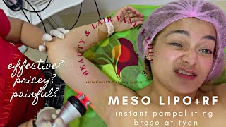 MESO LIPO  RF CAVITATION  NON SURGICAL LIPO TREATMENT [upl. by Eugine]