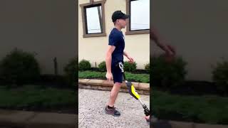 Hemipelvectomy Amputee Running with Prosthetic Leg  Kristofer [upl. by David612]