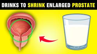 quotShrink Your Prostate in Just Days 8 Miracle Drinks Doctors Wont Tell You Aboutquot [upl. by Demmy995]