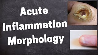 Acute Inflammation Morphology [upl. by Goran]