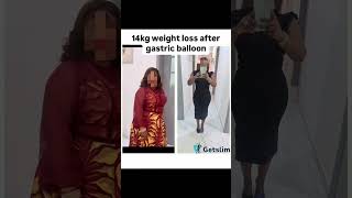 14kg Weight loss after Gastric Balloon [upl. by Ennaecarg]