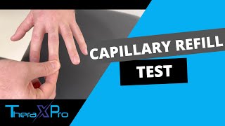 Capillary Refill Test  Peripheral Tissue Blood Flow [upl. by Erodisi]