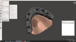 3D printed hybrid Meshmixer and Romexis [upl. by Euginomod78]