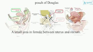 Anatomy and Clinical anatomy of Pouch of Douglas Rectouterine pouch Rectovesical pouch [upl. by Williamsen]