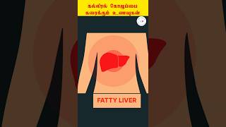 கல்லீரல் கொழுப்பை கரைக்கும் உணவுகள்  fattyliver healthtips  Dr Sagul R Mugunthan [upl. by Conal622]