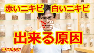 【ニキビ】原因とすぐに出来る【養生法】漢方薬剤師が解説！ 思春期にきび 大人にきび ニキビ跡 肌荒れ スキンケア [upl. by Esbensen178]