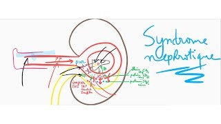 🔴 LEXPLICATION LA PLUS CLAIRE DU SYNDROME NEPHROTIQUE   DR ASTUCE [upl. by Hewett]