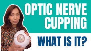 What is Optic Nerve Cupping [upl. by Christabelle]