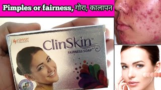 ClinSkin fairness soap uses in hindi कील मुहासे pimples darkness गोरा रंग [upl. by Primrosa]