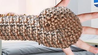 ASMR Animation trypophobia 🤯sleep in big size treatments Hand  asmr animation treatmentfilmiASMR [upl. by Daugherty]