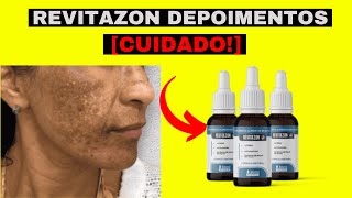 REVITAZON DEPOIMENTO ANTES E DEPOIS  REVITAZON FUNCIONA MESMOREVITAZON TRATAMENTO DE MELASMA [upl. by Hesler]