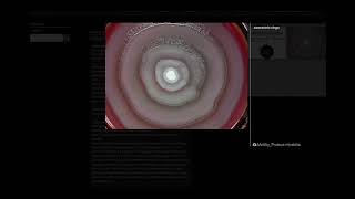 Swarming Motility of Proteus mirabilis  Microbiology [upl. by Norling]