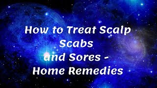 How To Treat Scalp Scabs and Sores  Home Remedies [upl. by Kirshbaum]