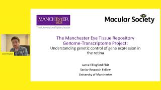 How genetic changes can lead to macular disease in some people with Dr Jamie Ellingford [upl. by Araeic]