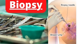 Biopsy Test Result And Procedure in हिंदी  क्यों करते हैं बायोप्सी जानिए  Benaturalbefit [upl. by Zielsdorf340]