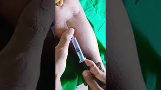 Blood collection🩸🩸🩸💉💉💉shortvideo viralvideo bloodcollection short [upl. by Sivlek194]