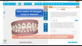 The Invisalign Clincheck Process from start to final approval video [upl. by Rainie414]