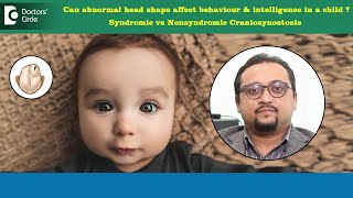 Does head shape affect intelligence Craniosynostosis  Head shape DrVybhav DerajeDoctors Circle [upl. by Baird115]