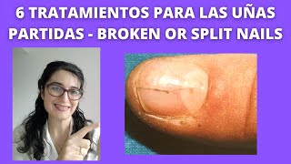 Treatment for BROKEN NAILS or SPLIT NAILS 💅 6 TrataMientoS para UÑAS PARTIDAS 💅 [upl. by Elden]