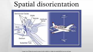 Spatial disorientation [upl. by Clercq197]