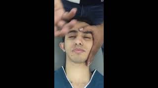 Facial palsy Rehabilitation practical [upl. by Nirual969]