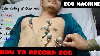 How To Record ECG  ECG leads Color Coding And Placement Location  ECG Machine [upl. by Michaud333]