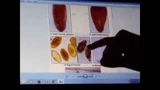 practical parasitology  DrMohammad Ezzat [upl. by Weiman]