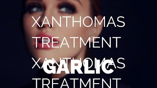 Xanthomas treatment garlic Is it an effective treatment [upl. by Adnaluy]