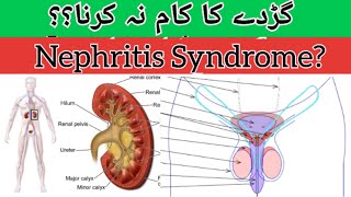 Nephrotic syndrome नेफ्रोटिक सिंड्रोम  Causes Symptoms Treatment in HindiUrdu [upl. by Eirellav]