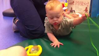 Down syndrome physical therapy exercises for children born with Down syndrome [upl. by Rollin]