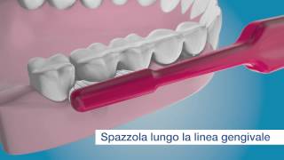 Pulisci ésterno dei tuoi impianti con TePe Implant Brush [upl. by Alaekim309]