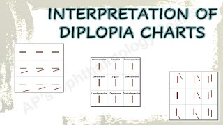 Interpretation of Diplopia Charts [upl. by Buseck]